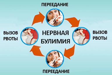 Лечение булимии в Новоаннинском